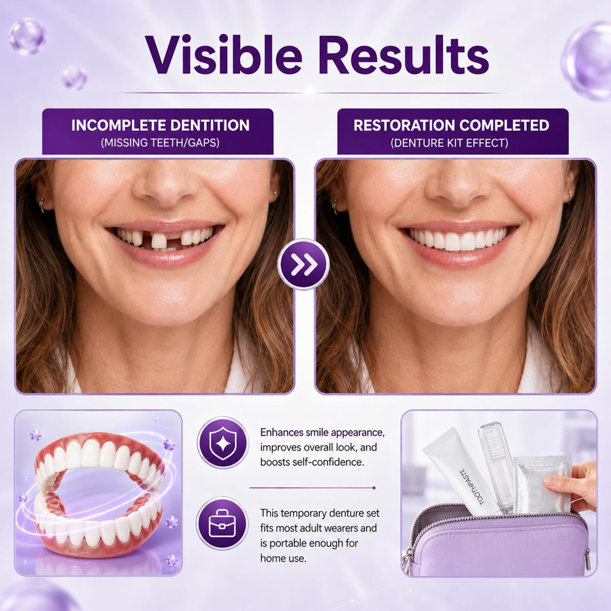Heat Moldable Temporary Denture Kit 1 Set X8852